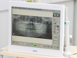 カウンセリング