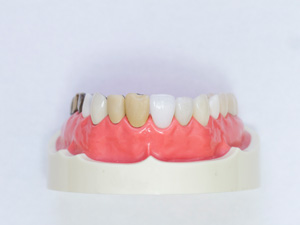 カウンセリング