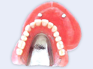 マグネットデンチャー